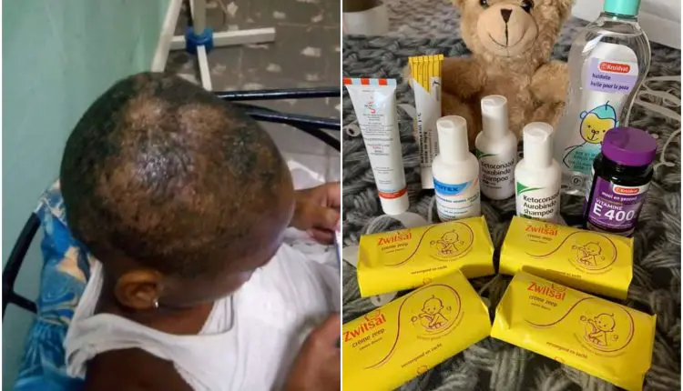 niña residente en La Habana que necesita medicamentos