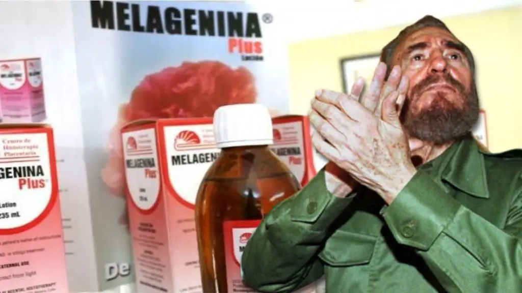 Melagenina, la cura "mágica" del vitiligo que Fidel Castro utilizó como un gran filón de negocio para ganar millones de dólares en total silencio